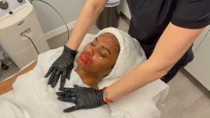 facial treatmant-2