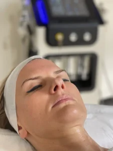 hidrofacial-gallery-4