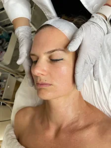 hidrofacial-gallery-5