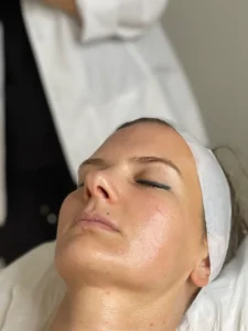 hidrofacial-gallery-7