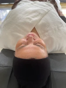 microneedling-gallery