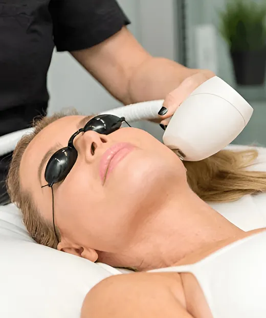 photofacial treatments