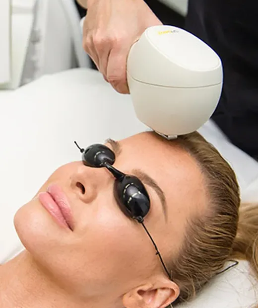photofacial treatments